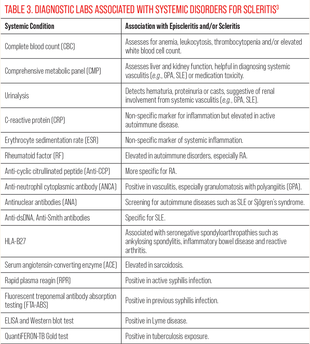 Table 3. Diagnostic Labs Associated with Systemic Disorders for Scleritis