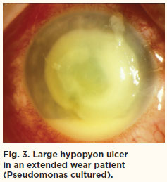 fig3